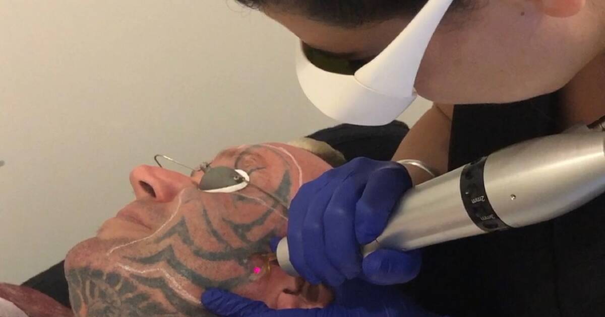 MAFS' Ryan Gallagher shows off dramatic results of tattoo removal