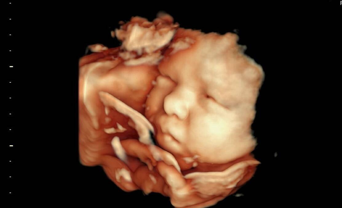 Life: A baby in the womb. Picture: Renaye Valaire 