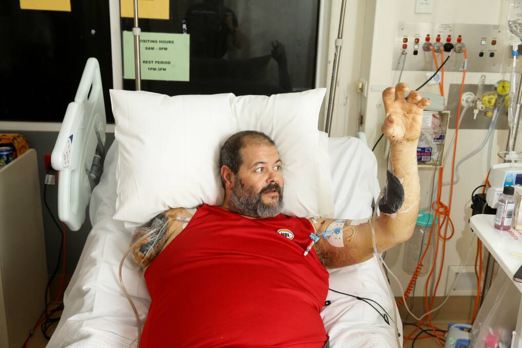 Dog attack: Mechanic Brendan "Bear" Clark was working on a Coonamble property when he was mauled by two large dogs. He is recovering at John Hunter Hospital after losing his right arm in the traumatic attack. Picture: Jonathan Carroll