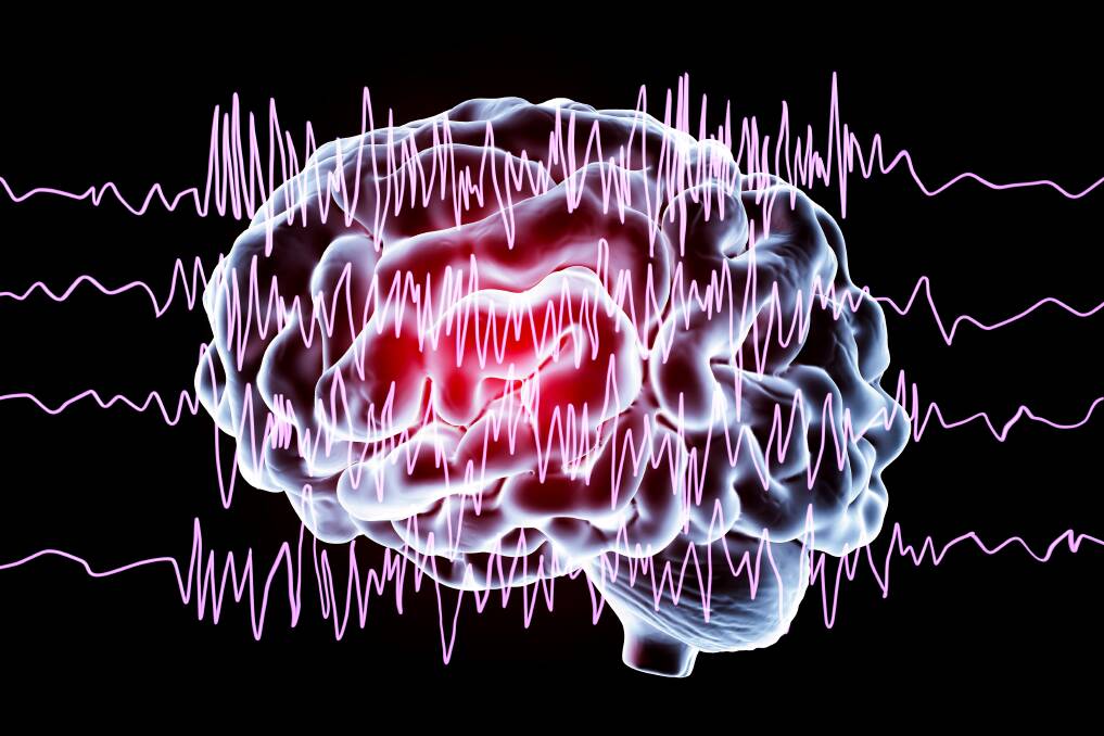 AWARENESS: Epilepsy occurs on a spectrum, like autism, varies in severity from person to person and can be acquired at any time in life from things like injury, infection or stroke.