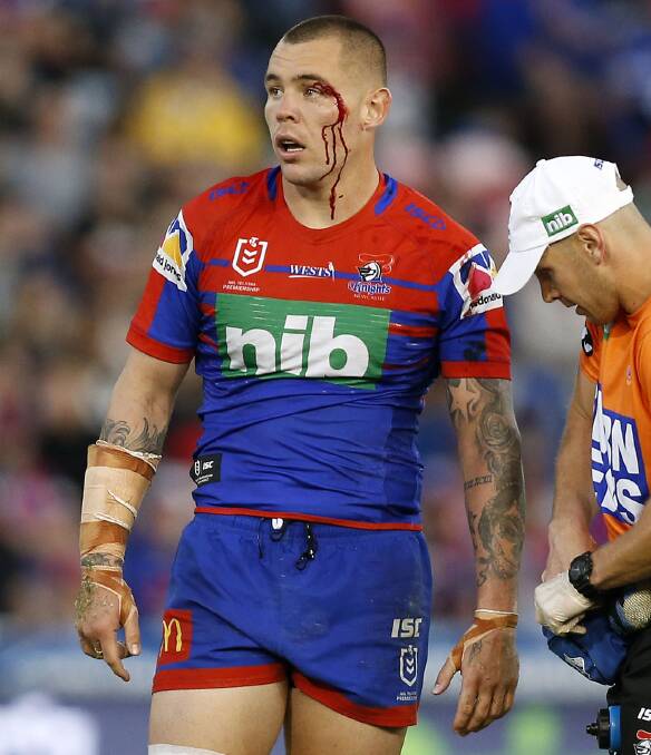 WAR WOUND: David Klemmer shed blood for the cause. Picture: Darren Pateman, AAP