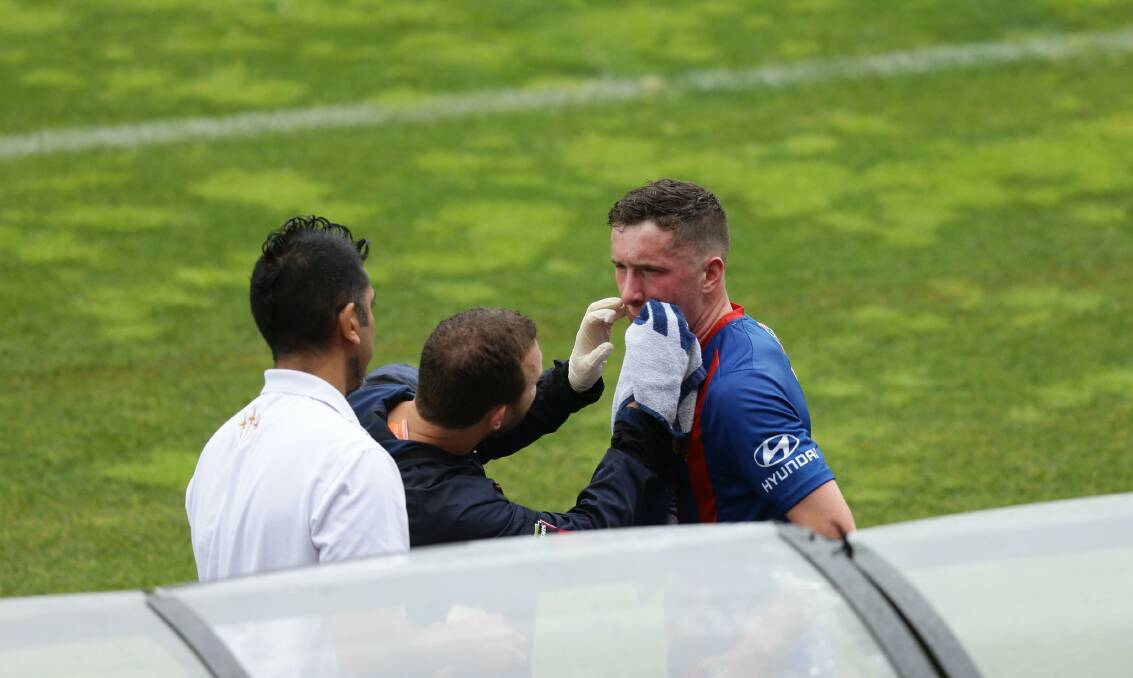 FRIENDLY FIRE: Bobby Burns receives treatment after copping a ball to the face.