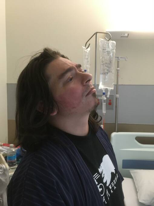 PAIN: Jim Johnson in hospital waiting for surgery to his broken jaw. His family say he was attacked after he left a bottle shop in Shortland last Thursday, August 27.