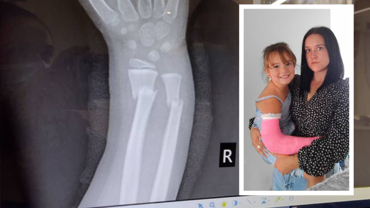 OUCH: An X-ray of Aleera's arm after she broke two bones while playing at school. She has since undergone a procedure to reset the bones, and inset, Aleera Ross with mum Sarah Cumberland.
