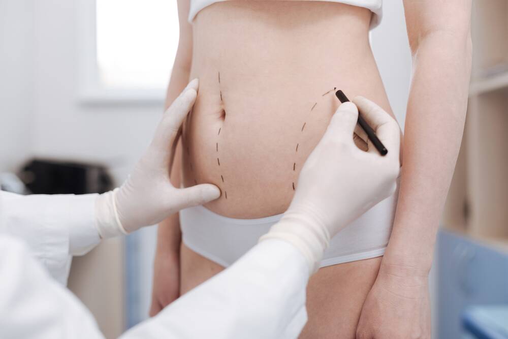 Why liposuction has become the normal for so many
