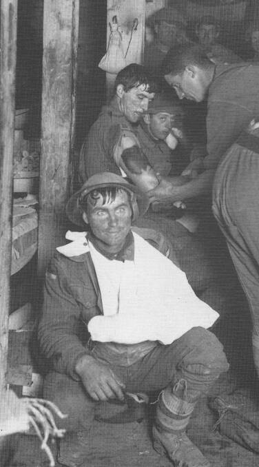 SHELL SHOCK: A wounded WWI soldier, possibly Pte George Masters.