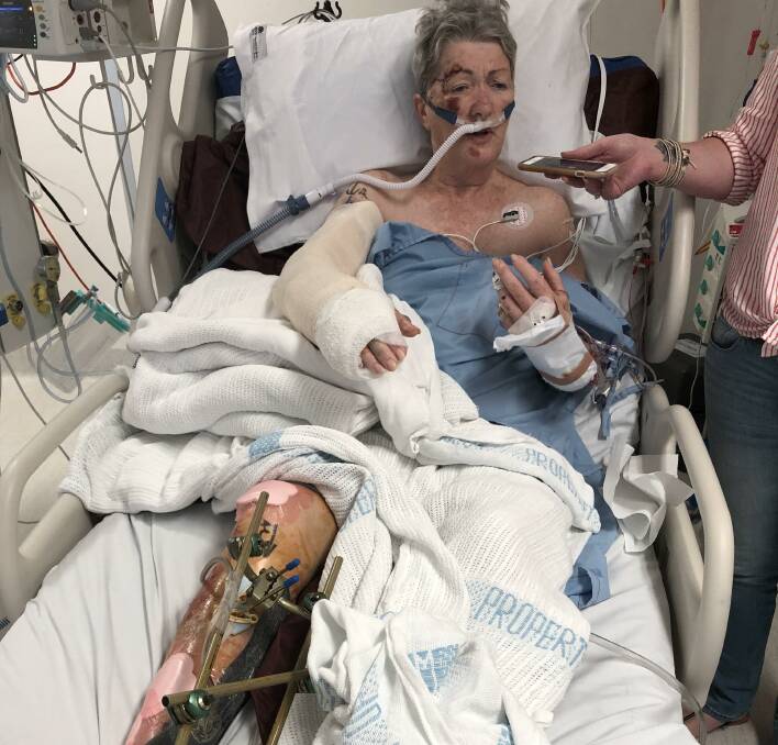 Long recovery: It has been 12 months since Elizabeth Stringer was run over by her own car. Picture: Supplied