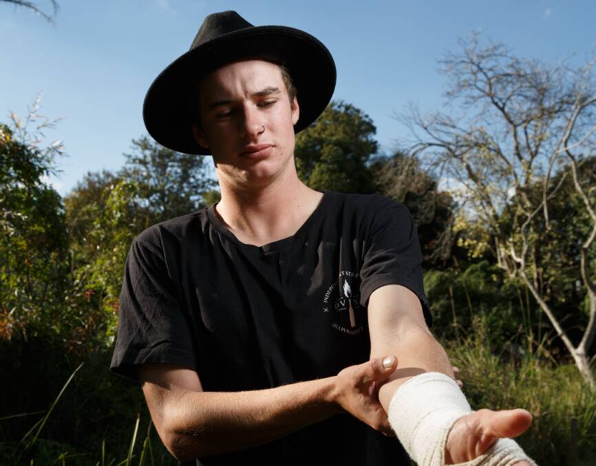Story to tell: Max Carey shows the area of his arm where he was bitten by a grey nurse shark at Tomaree. Picture: Max Mason-Hubers