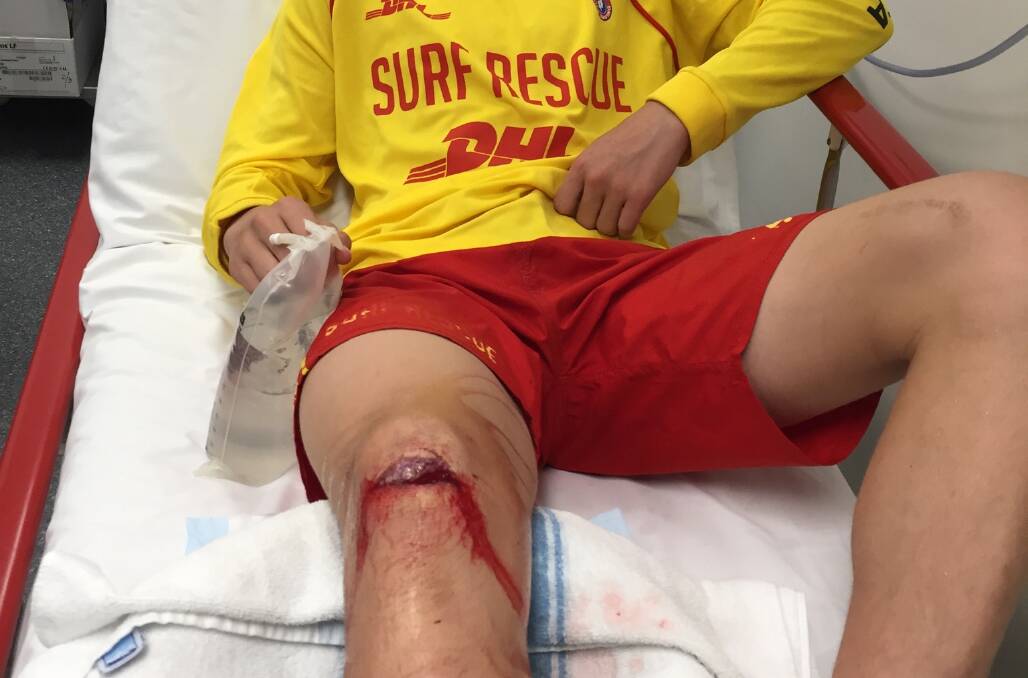 INJURED: A 14-year-old Stockton volunteer surf lifesaver suffered a severe knee laceration, that required surgery, after falling on a rock disguised by sand. 