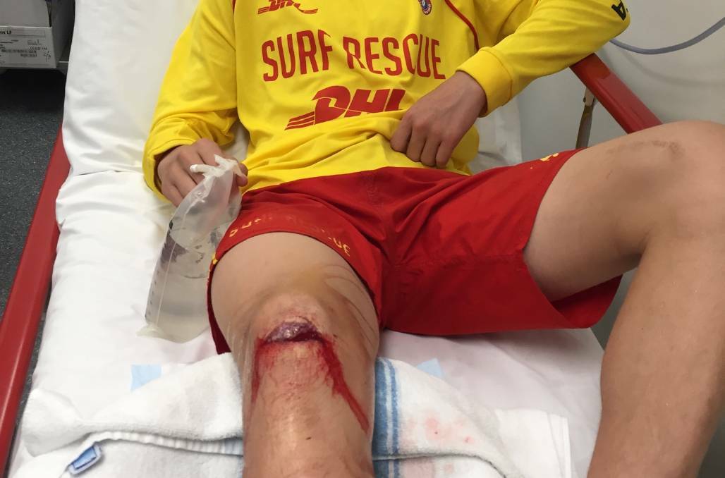 INJURED: A volunteer junior surf lifesaver was badly hurt when he fell on a rock disguised below the sand on Stockton beach in September. 