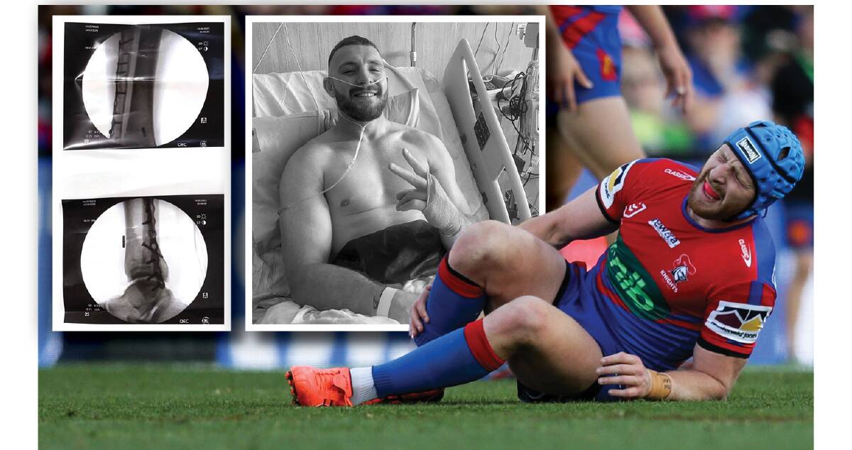 Jackson Hastings clutching his leg last month. Inset, the X-rays and the halfback in hospital. Picture by Jonathan Carroll 