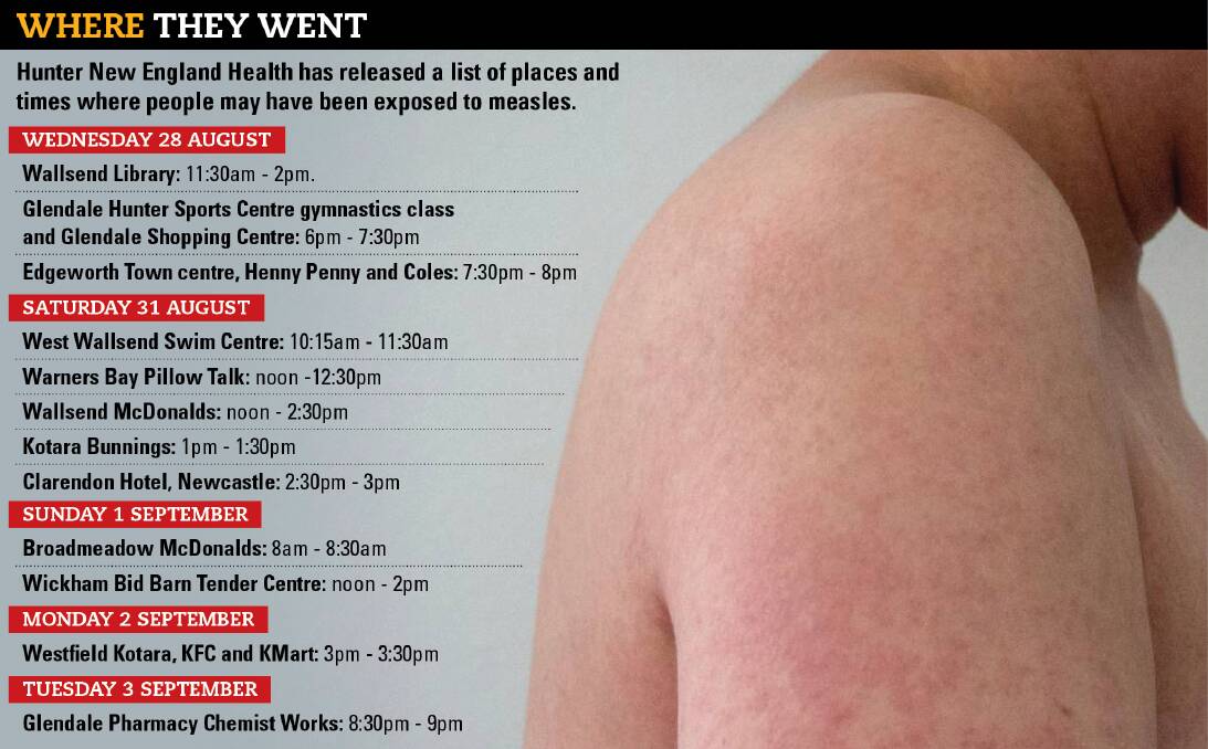 Measles alert for Newcastle, Lake Macquarie after two confirmed cases