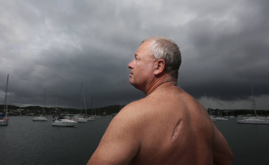 Sailor and cancer survivor Garry van Dijk, with the scar on his back after the removal of a melanoma in 2018. Picture: Simone De Peak 