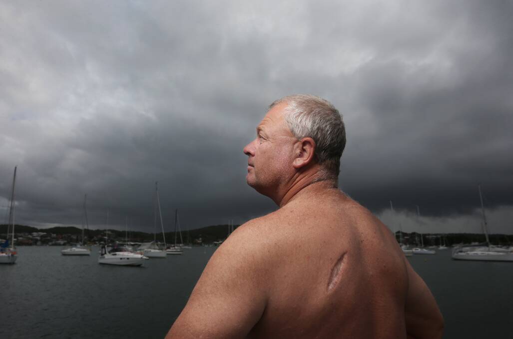 Sailor and cancer survivor Garry van Dijk, with the scar on his back where a melanoma was removed. Picture: Simone De Peak 