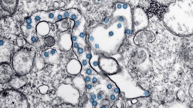 The particles of COVID-19, in blue, from the first US case of the coronavirus.