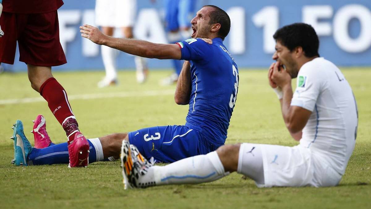 Luis Suarez after that bite. 
