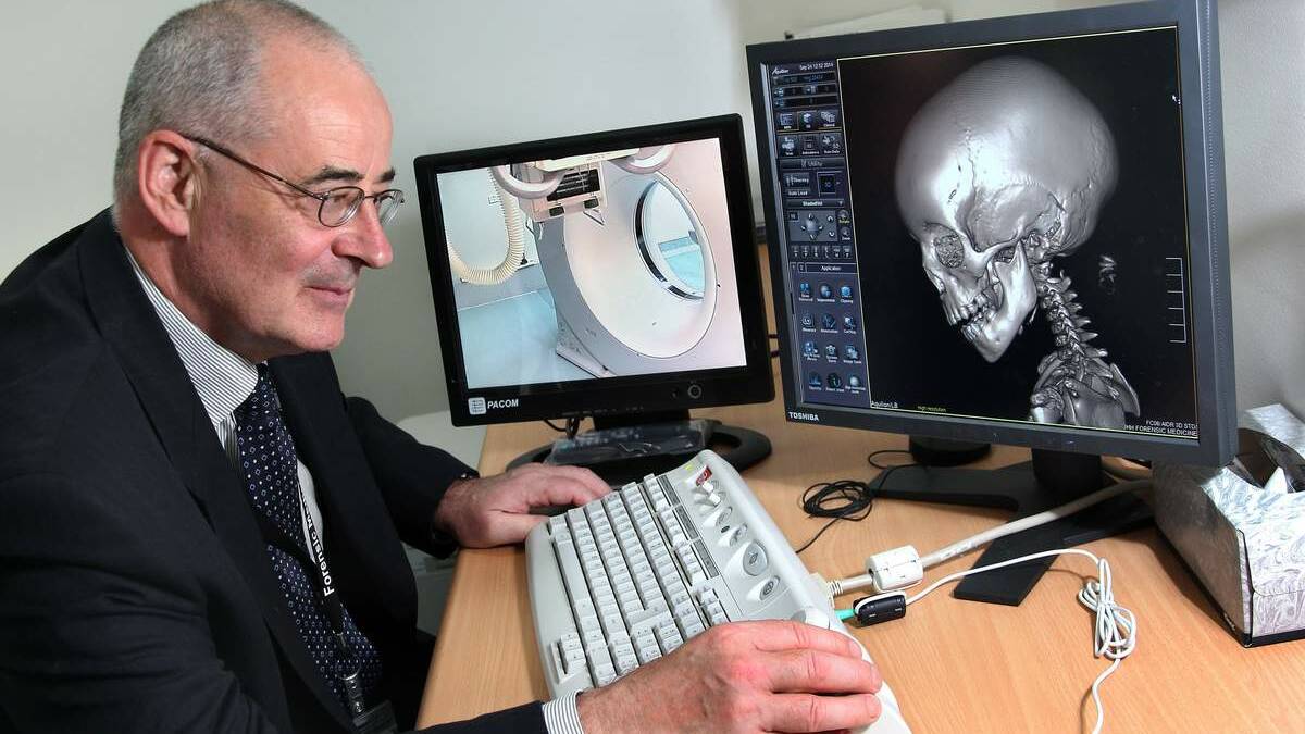  Clinical Director of Forensic Medicine Professor Tim Lyons with computer demonstration of CT scanner which has been installed at the Department of Forensic Medicine at Newcastle.
