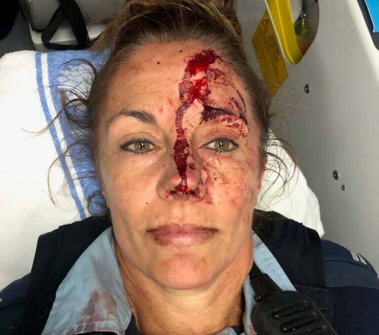 The injured officer. Picture: NSW Police