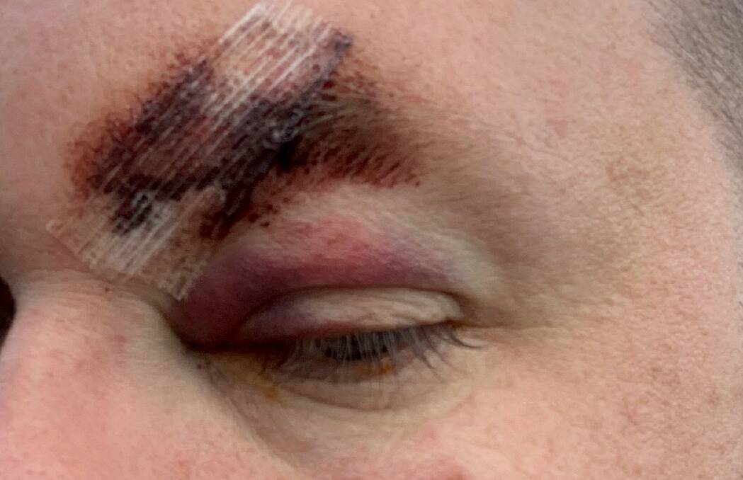 The aftermath of the alleged assault on Sunday night. Picture: NSW Police