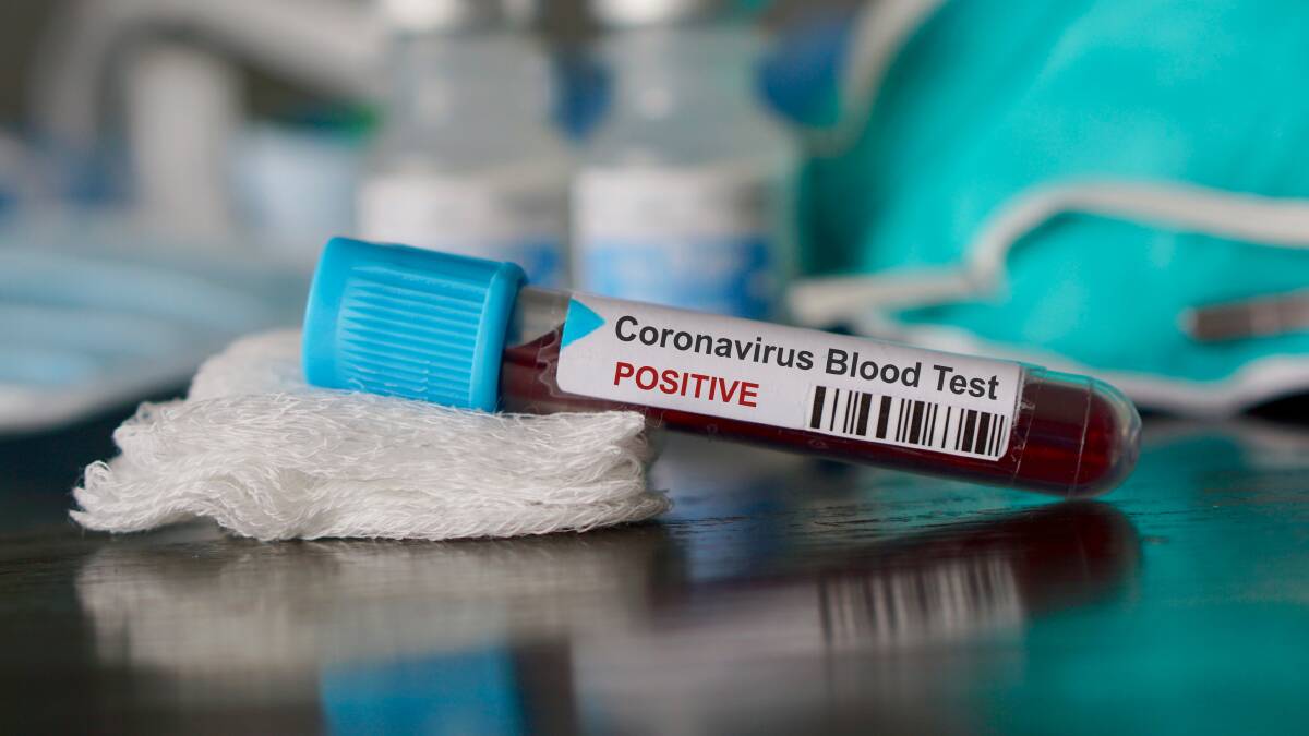 Two more Hunter people test positive for COVID-19