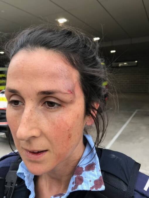BRUISED AND BLOODIED: The senior constable who was allegedly pushed to the ground and cracked her head at Gosford Hospital. Picture: NSW Police 